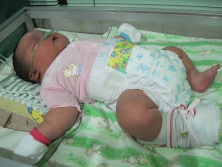 SUPER BESAR--Bayi pasangan Wiyono-Mulyati, warga Desa Sempukerep, Kecamatan Sidoharjo ini lahir dengan RS Bersalin Fitri Chandra dengan berat 6 kg, Sabtu (15/1) pagi. Saat ini, bayi itu dirawat di RS Anak Astrini. Foto diambil Minggu (16/1). (FOTO:Suharsih)