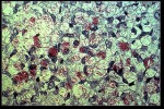 Mycobacterium Leprae (wikipedia)