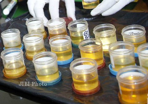 Ilustrasi tes urine (JIBI/Solopos/Antara)
