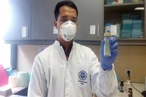 Seorang petugas menunjukkan bakteri TB dalam tabung di Laboratorium Tuberkolosis Departemen Mikrobiologi FK UGM, Kamis (24/3/2016). (Abdul Hamied Razak/JIBI/Harian Jogja)