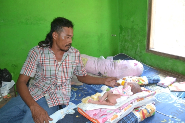 Sri Rejeki, 37, memberi minum susu bayinya yang menderita benjolan daging di bagian punggungnya di rumahnya di Dusun Kuncen, Desa Waru, Kecamatan Baki, Selasa (2/8/2016). (Bony Eko Wicaksono/JIBI/Solopos)