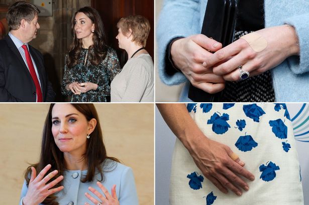 Kate Middleton gunakan plester (Mirror.co.uk)