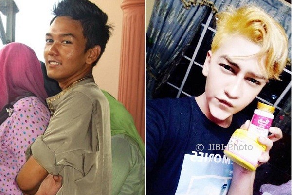 Amirul Rizwan Musa sebelum (kiri) dan sesudah (kanan) operasi plastik (Asiaone.com)