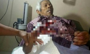 Mbah Parmo, 82, terluka tangannya akibat serangan monyet liar di Desa Bangkok, Karanggede, Selasa (1/8/2017) lalu. (Istimewa)