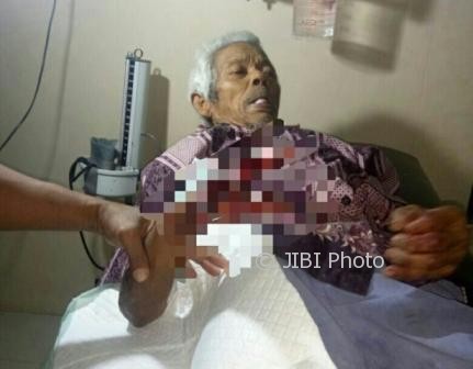 Mbah Parmo, 82, terluka tangannya akibat serangan monyet liar di Desa Bangkok, Karanggede, Selasa (1/8/2017) lalu. (Istimewa)