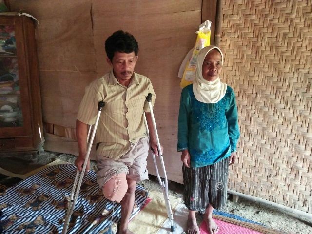 Miskan, seorang tukang pemotong kayu di Ponorogo, kehilangan satu kakinya setelah terkena gergaji mesin saat bekerja. Foto diambil Selasa (1/8/2017). (Abdul Jalil/JIBI/Madiunpos.com)