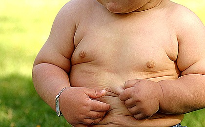 Waspadai Obesitas Pada Anak!