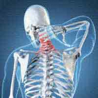 Hari Osteoporosis Sedunia, Ini 6 Cara Hindari Tulang Keropos