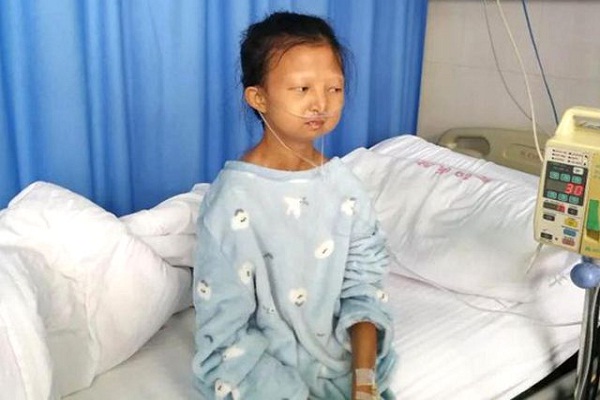Miskin, Wanita China Makan Nasi Cabai 5 Tahun Hingga Meninggal