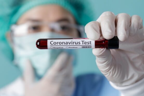 Ilustrasi tes virus corona salatiga atau Covid-19 italia Indonesia pasien positif RSUD dr Moewardi Solo PDP corona sukoharjo magetan rapid test pemudik nguter ODP sukoharjo