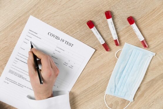 Jawa Tengah Tes Covid-19 Positif Covid-19 Indonesia Meninggal, Vaksin Virus Corona Tes Usap Sragen Positif Covid-19 Data Data Sragen Sukoharjo Kota Solo Pasien Boyolali Tipe Kasus Baru Indonesia Pasien Simo Boyolali Kasus Positif Covid-19 Kota Solo PDP Boyolali Positif Corona Sukoharjo update clatement Covid, situasi kasus covid-19 kota solo teras positif, rapid test petugas pemilu boyolali