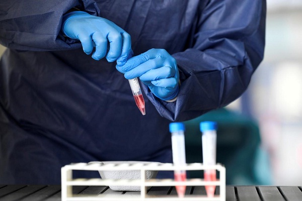 Usai Pilkada, Pemkab Boyolali Bakal Gencarkan Screening Untuk Deteksi Kasus Covid-19