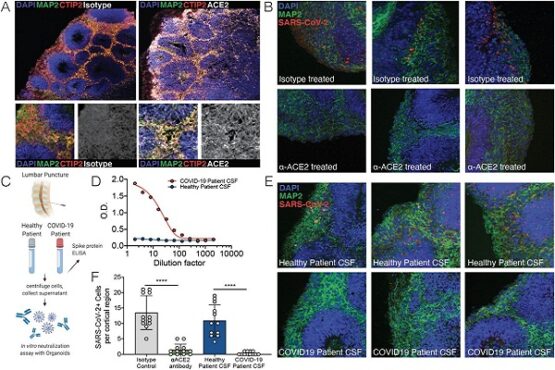 Serangan virus Corona di otak. (Biorxiv.org)