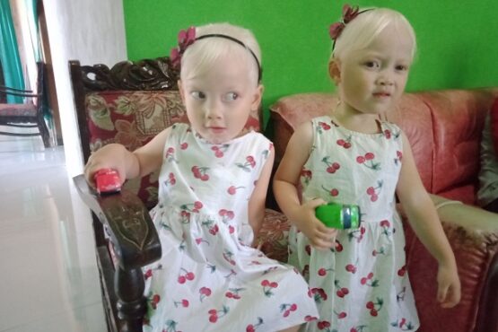viral albino kembar Wonogiri