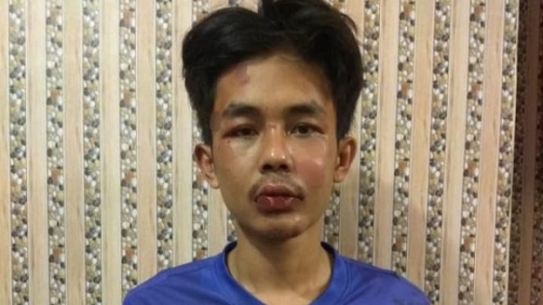 PN Tanjung Karang Hukum Penusuk Syekh Ali Jaber Lebih Ringan dari Tuntutan Jaksa