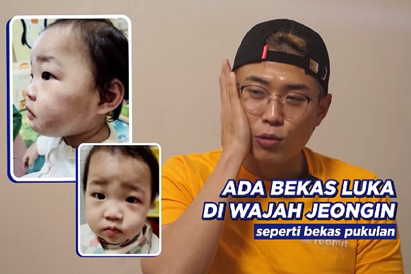 9 Bulan Diadopsi, Anak Balita Disiksa Hingga Tewas