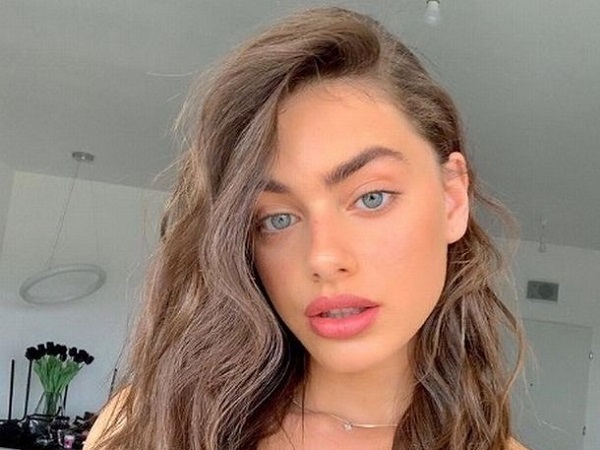 Dinobatkan Wanita Tercantik di Dunia, Model Asal Israel Malah Dapat Komentar Jahat