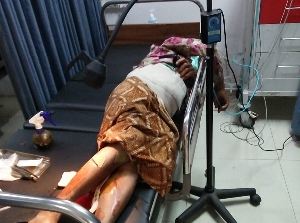 Tak Konsentrasi, Pengendara Motor Tabrak Seorang Nenek di Sentolo