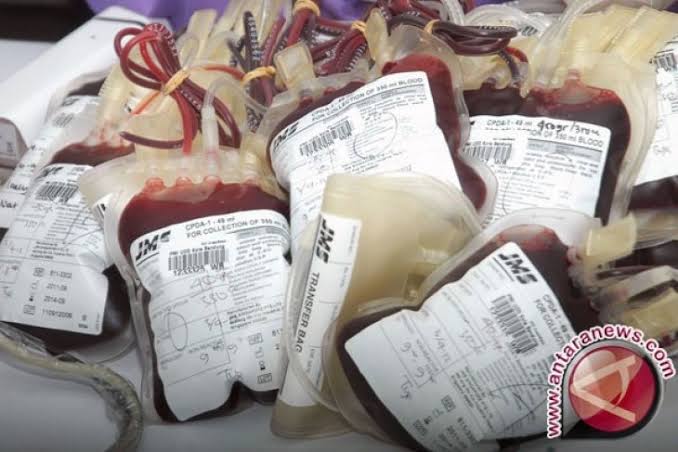 Stok Darah PMI Karanganyar Hari Ini 29 September 2022