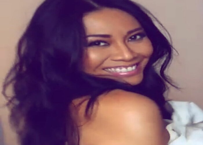 Tak Hanya Chelsea Olivia, Deretan Artis Ini Hilangkan Gigi Gingsul