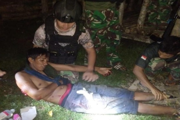 Kondisi satu korban luka tembak di lengan kanan saat dievakuasi ke Pos Satgas Satuan Organik Yonif RK 136/TS Kampung Mayerga, Kamis (29/9/2022) (ANTARA/HO-Satgas Yon RK136/TS)